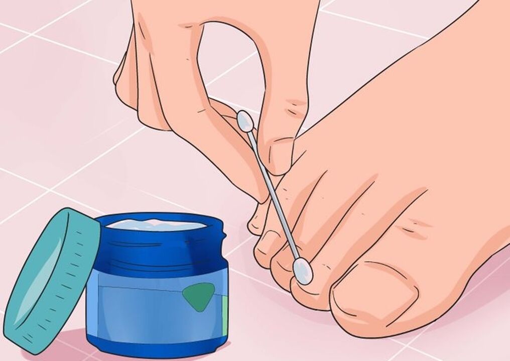 Cure nails mushrooms