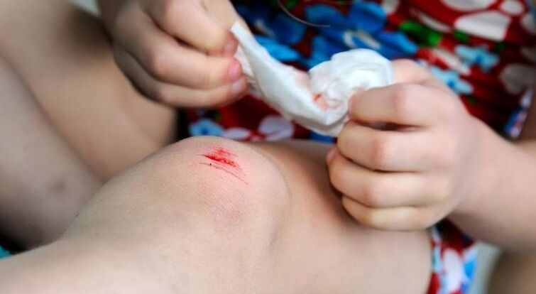 How can you get an infection with a fungus